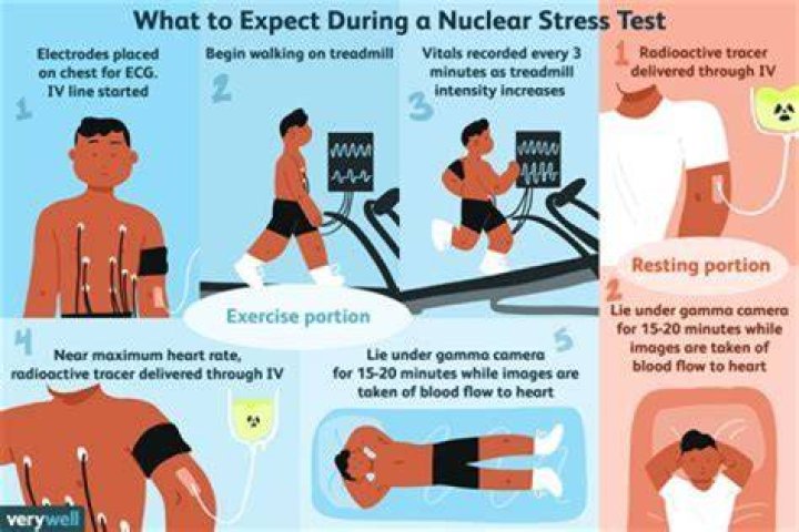 How often should you have a nuclear stress test done?