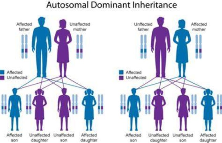 What is complex inheritance health issue?